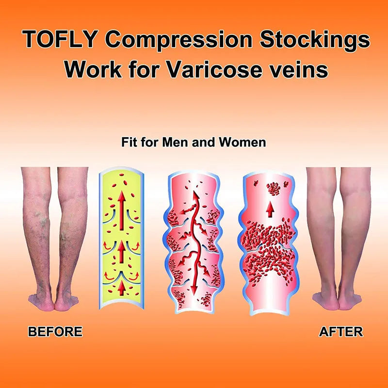 2PCS Compression Stockings Medical Grade 23-32mmHg Leg Calf Compression Socks Varicose Veins Edema Shin Splints Nursing Support