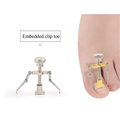 Tcare Ingrown Toenails Correction Pedicure Foot Toe Nail Care Tools Straightening Clip Brace Corrector Ingrown Toe Nail Fixer