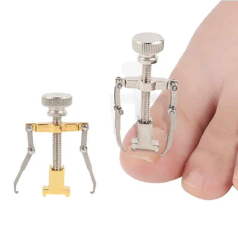 Tcare Ingrown Toenails Correction Pedicure Foot Toe Nail Care Tools Straightening Clip Brace Corrector Ingrown Toe Nail Fixer