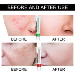 Skin Repair Cream Improves Dull Skin, Moisturizes and Cleanses Acne, Skin Repair and Care Cream