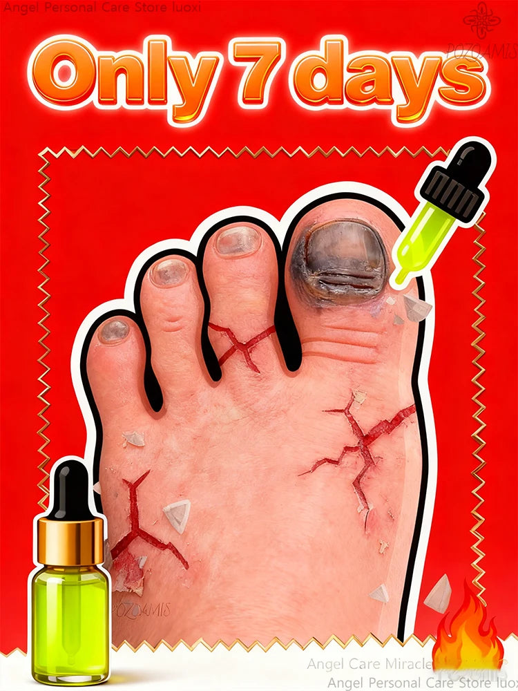 Scientifically formulated, acts directly on the nail bed, combats the root cause of the problem, and promotes healthy new nail