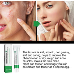 Skin Repair Cream Improves Dull Skin, Moisturizes and Cleanses Acne, Skin Repair and Care Cream