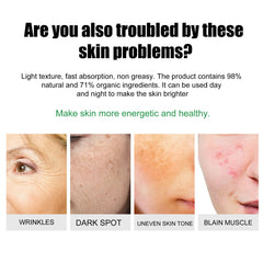 Skin Repair Cream Improves Dull Skin, Moisturizes and Cleanses Acne, Skin Repair and Care Cream