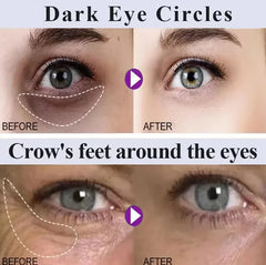 Beauty Salon Line-grade Black Gold Royal Jelly Collagen Light Wrinkle Eye Cream Care Anti Wrinkle Cream Eye Bags Contour Beauty